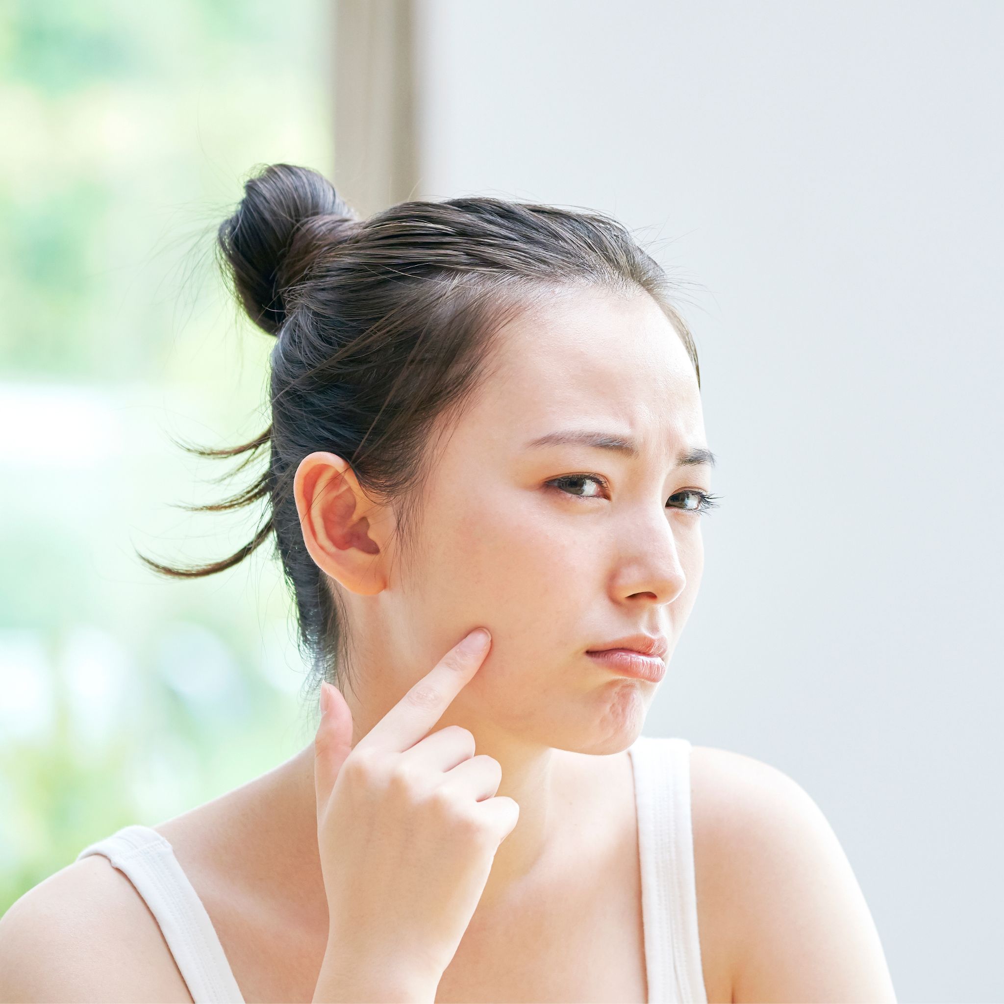 【札幌の美容皮膚科クリニックが解説】紫ニキビの原因・治療・予防・跡対策まで徹底ガイド