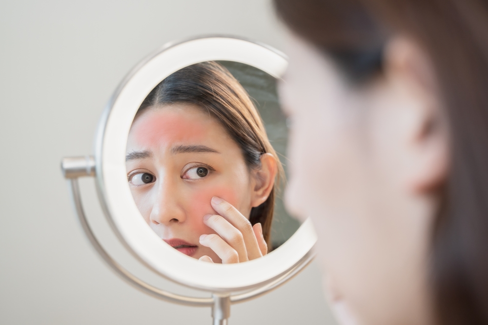 札幌市で赤み治療をお探しの方へ｜Vビームスポットで気になる部分をピンポイントケア