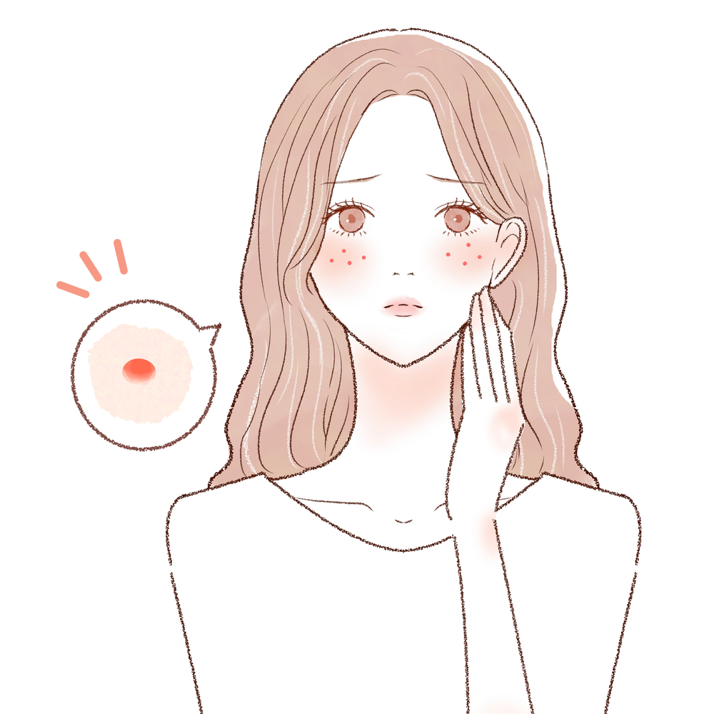 札幌市でニキビを病院に相談したい方へ|受診の目安と治療の考え方