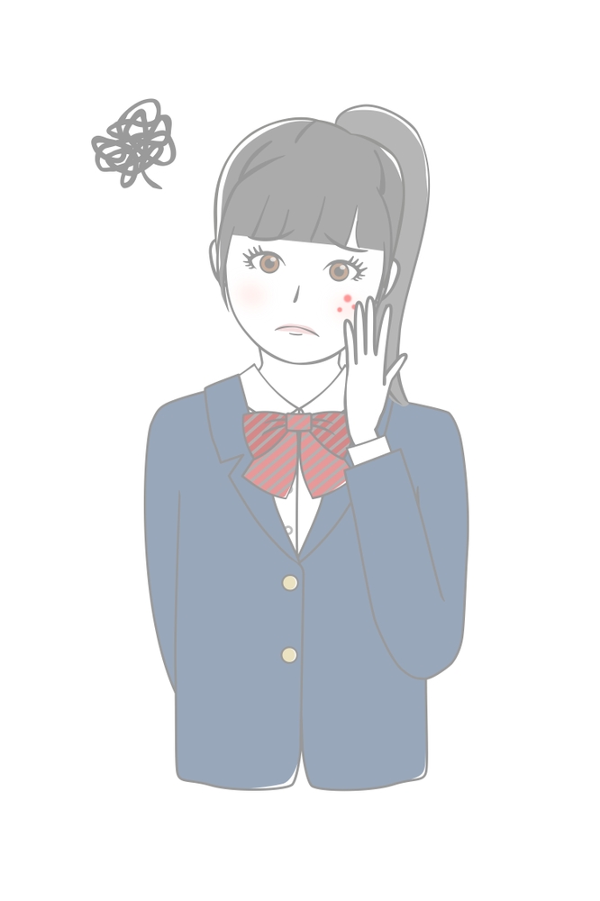 中学生のニキビはどうしたらいい？原因と対処法を当院がわかりやすく解説【札幌市】