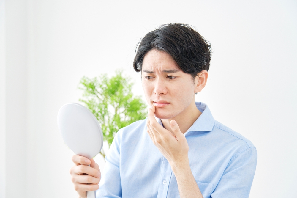男性ニキビが治らないときに見直したい原因と対処法｜札幌市で相談先を探す方へ
